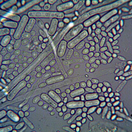 Cancer and Mitochondrial Dysfunction